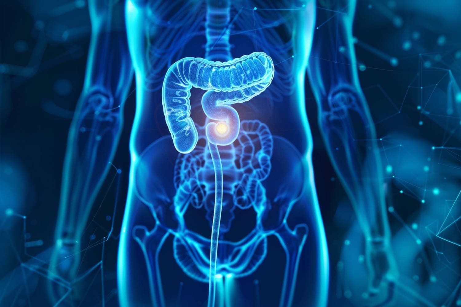 cirugia-para-obstruccion-intestinal-en-cdmx.jpg