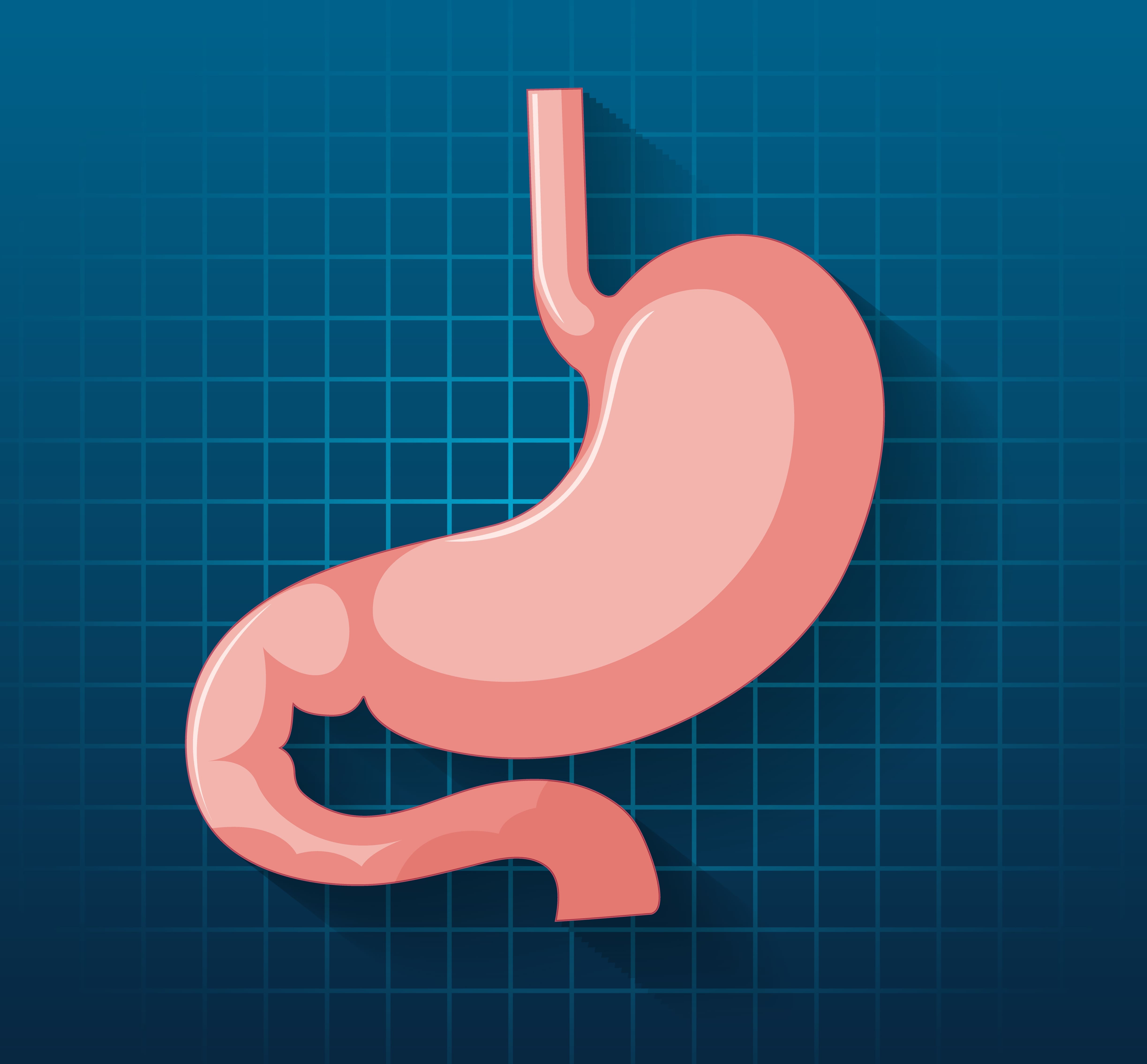 cirugia-para-reflujo-gastrico-en-cdmx.jpg